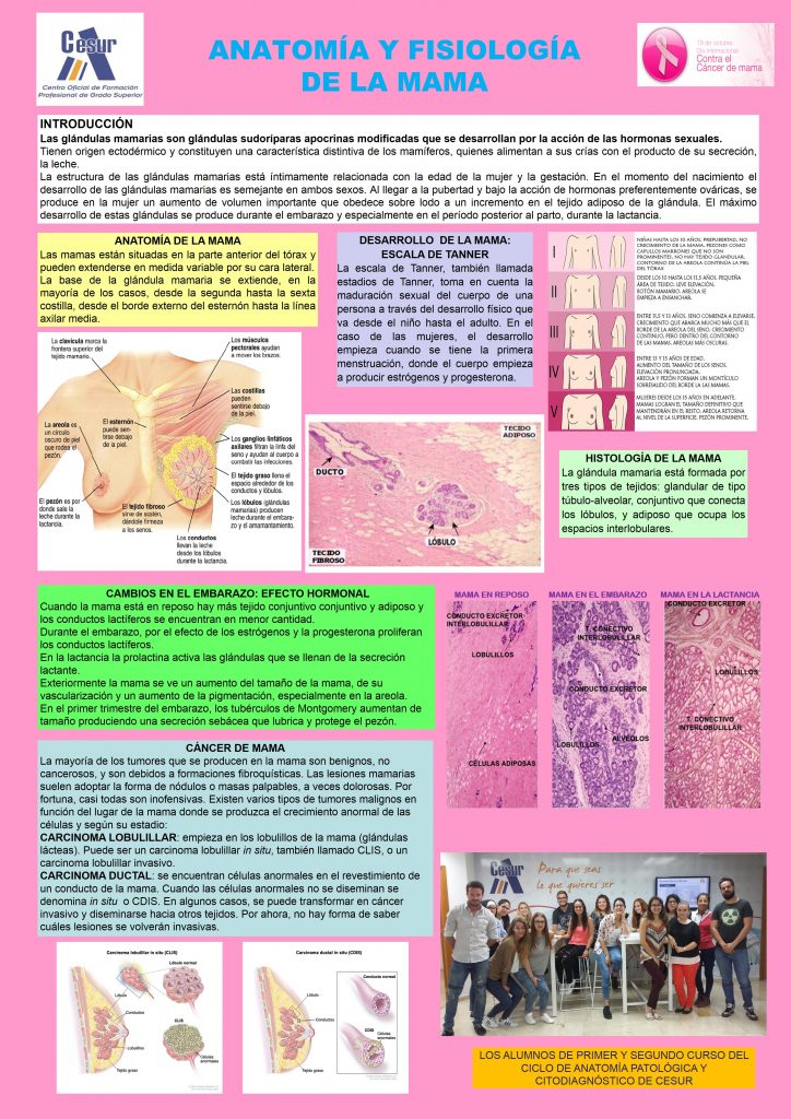 poster anatomía de la mama alumnos anatomía patológica poster cientifico