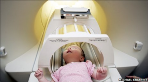 Resonancia Magnética en bebés