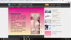 HIPOMASTIA