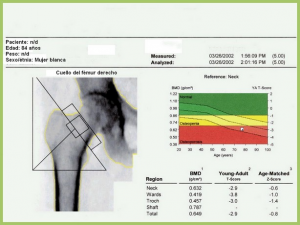 Osteodensitometría