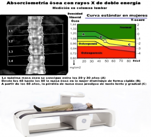 Absorciometría dual de rayos X