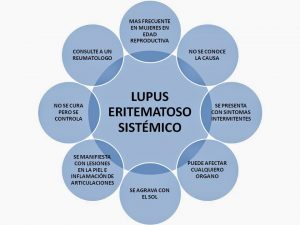 Lupus.