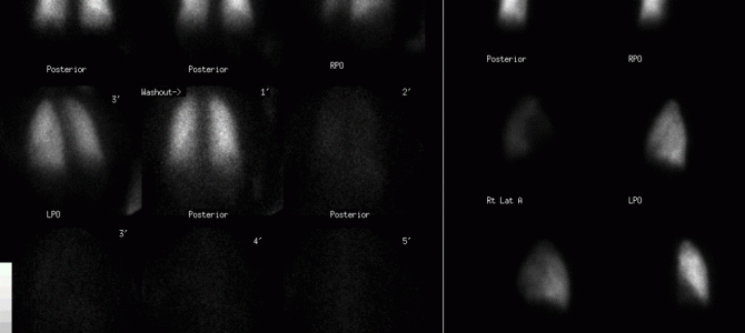 XENON-13, por Cristina Faya, CESUR Murcia.